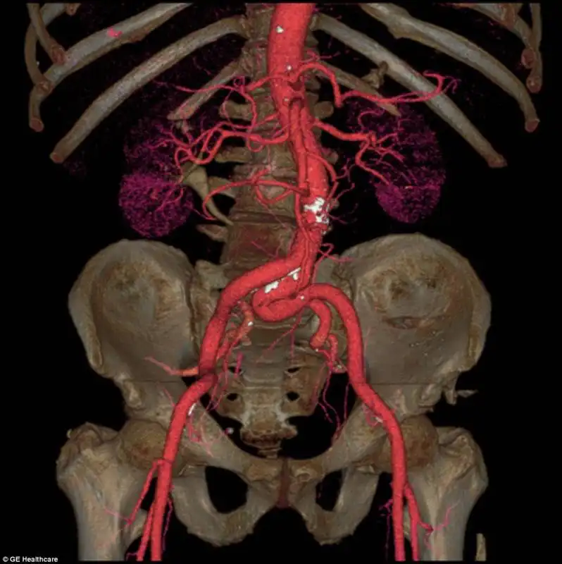 body scanner 9