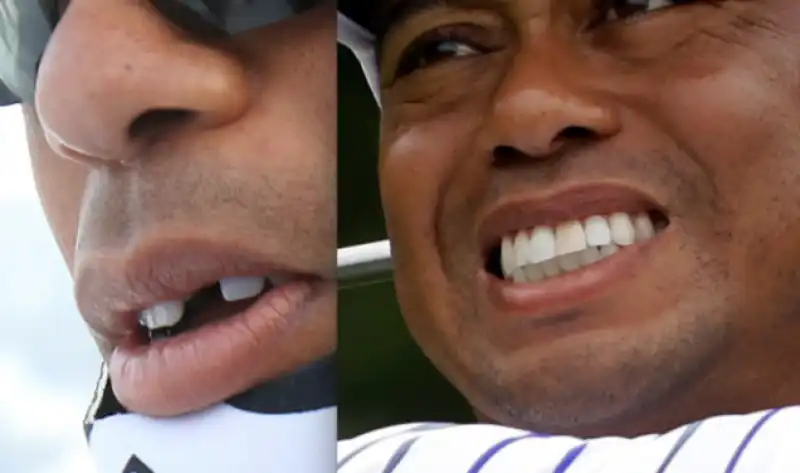 TIGER WOODS PERDE UN DENTE