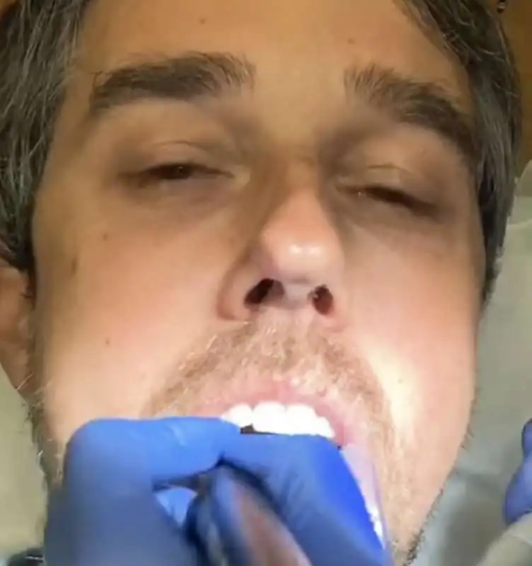 beto o'rourke dal dentista