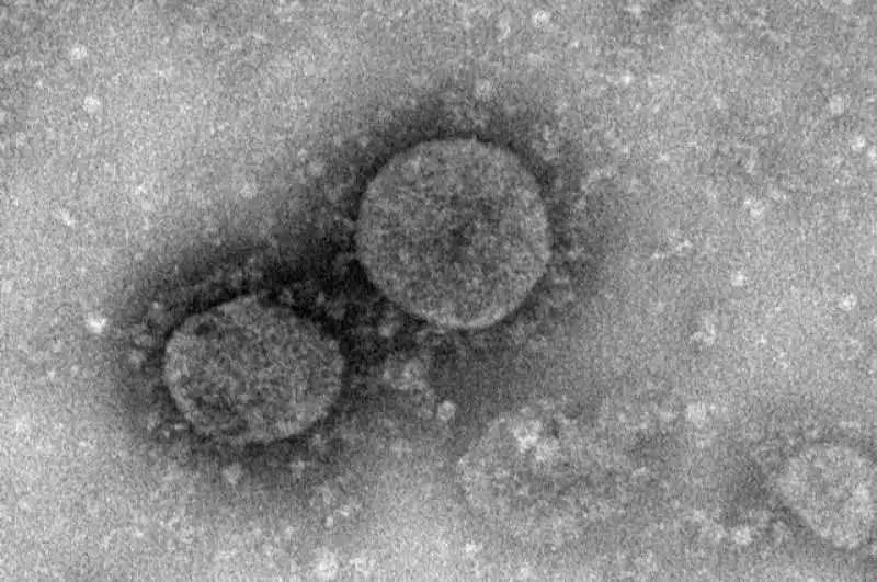 coronavirus 1