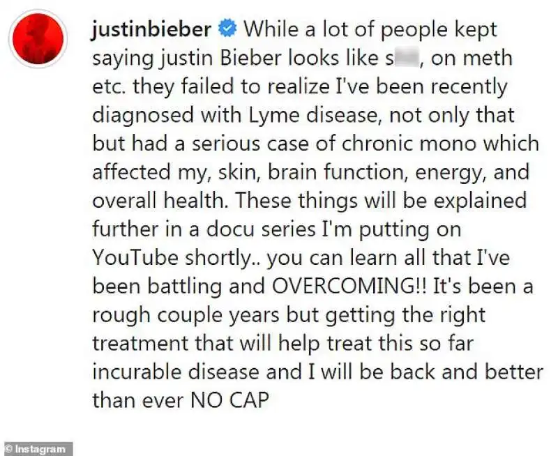 justin bieber confessa di avere la malattia di lyme