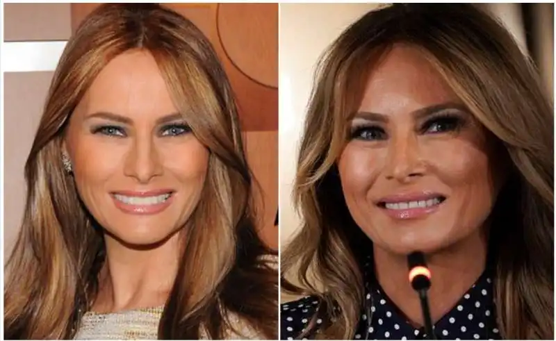 melania trump