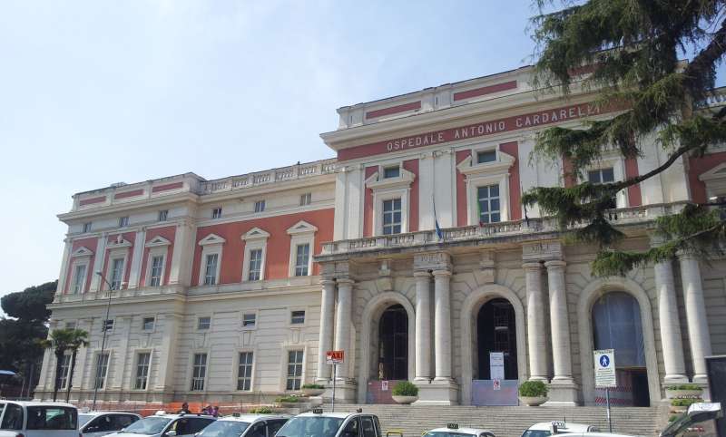 OSPEDALE CARDARELLI NAPOLI