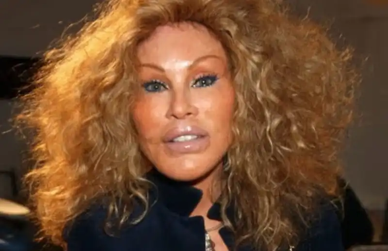 jocelyn wildenstein 1