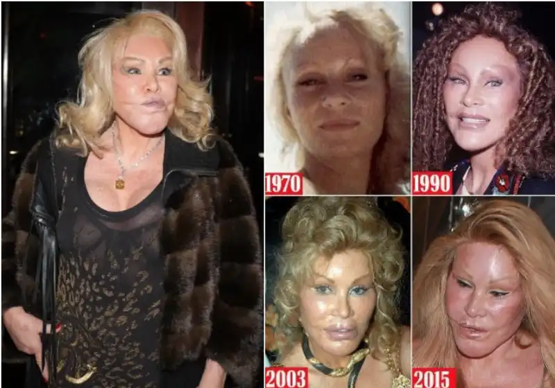 jocelyn wildenstein 2