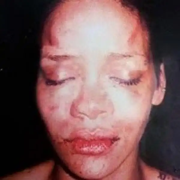 RIHANNA DOPO LAGGRESSIONE DA PARTE DI CHRIS BROWN 