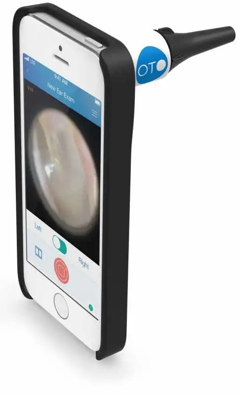 cellscope oto home   app per una visita otoscopica in remoto