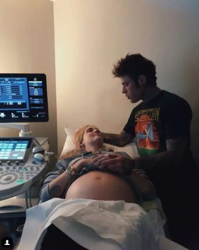 FEDEZ E CHIARA FERRAGNI