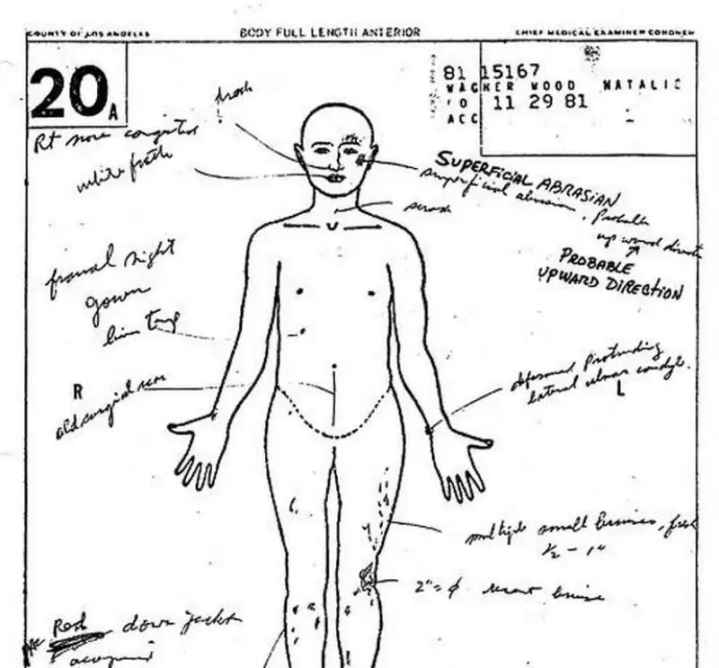 l autopsia di natalie wood