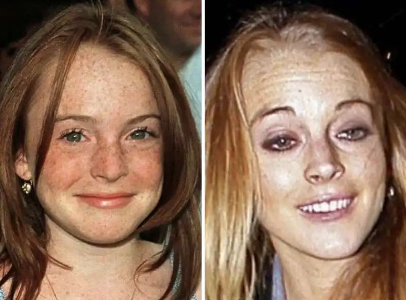 lindsay lohan prima dopo