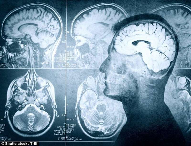 attivita cerebrale prima di morire