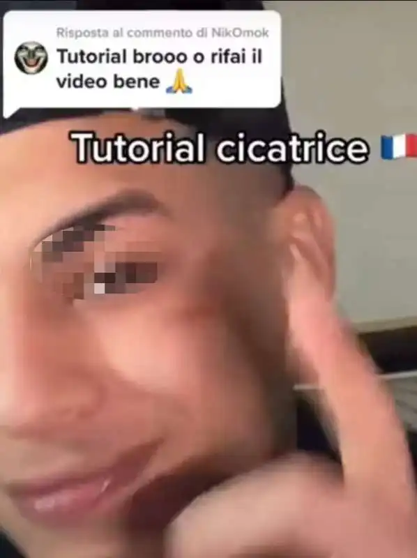 cicatrice francese su tiktok 6