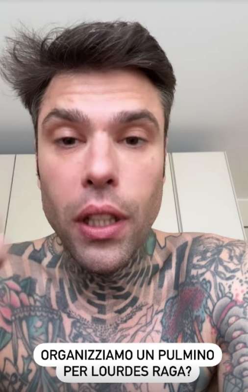 fedez si rompe un dente 2