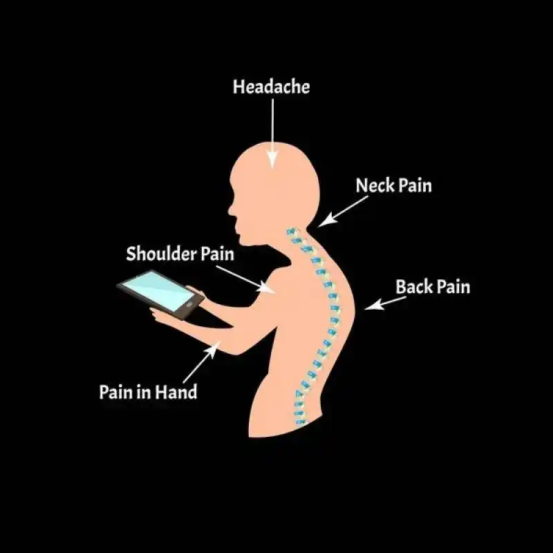 sindrome del collo da smartphone 5