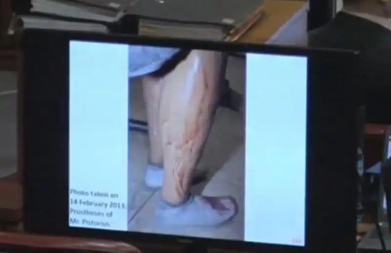 Le gambe di Pistorius inzuppate di sangue 