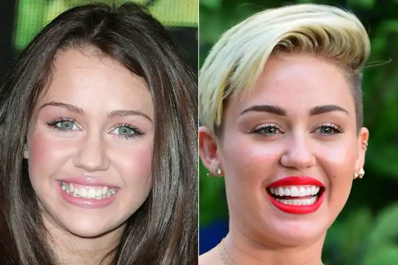 miley cyrus denti