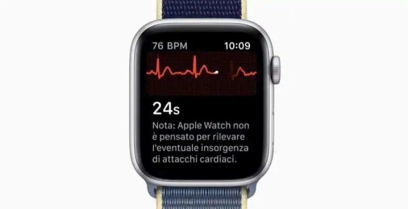 ecg apple watch 