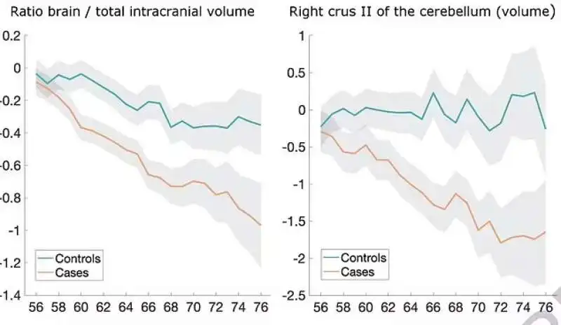 Diminuzione cervello pazienti Covid 2