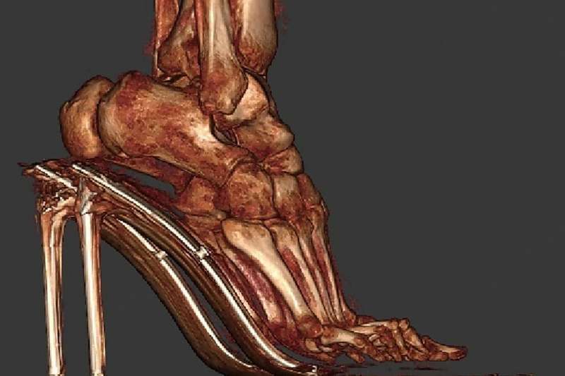 Scansione 3D dei piedi con tacchi alti