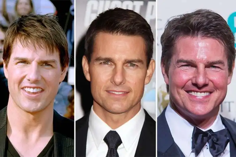 TOM CRUISE PRIMA E DOPO I RITOCCHINI