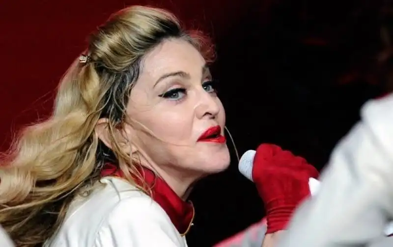 madonna botox