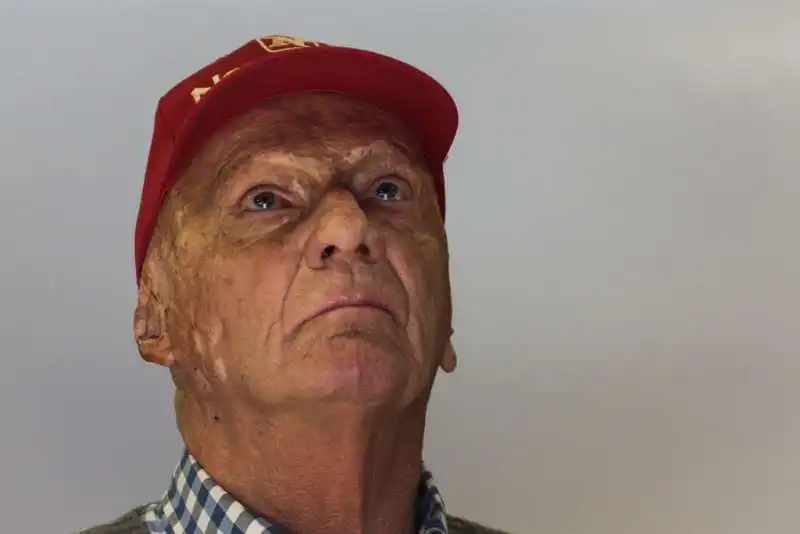 LAUDA