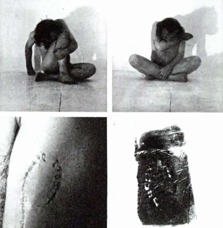 vito acconci self inflicted incisions