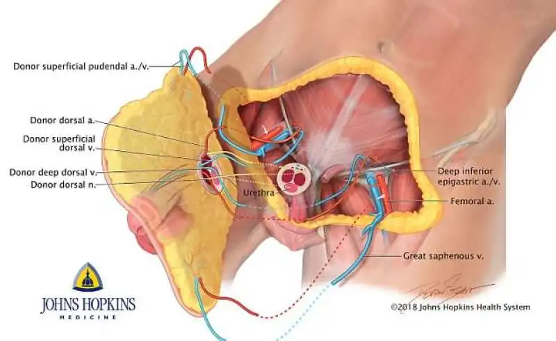 il primo trapianto di pene 2