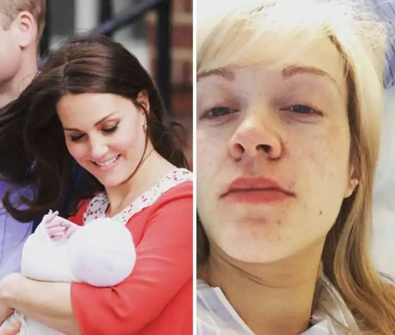 kate middleton vs. le mamme 4