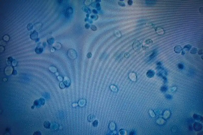 candida auris al microscopio