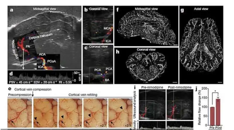 cervello di maiale riattivato dopo 4 ore dalla morte 1