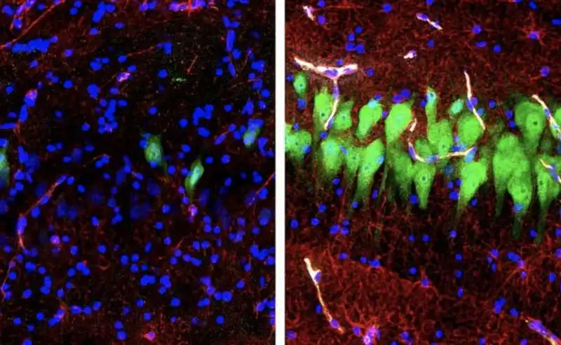 cervello di maiale riattivato dopo 4 ore dalla morte 5