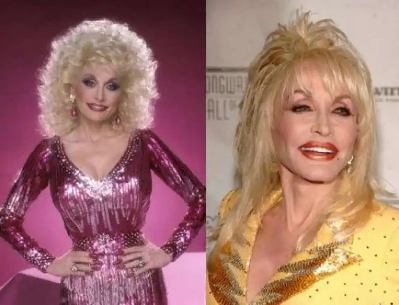 dolly parton