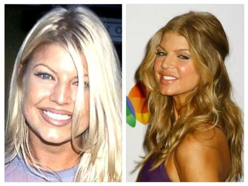 fergie