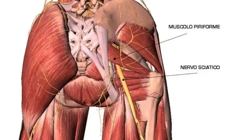 sciatalgia e lombagia 13