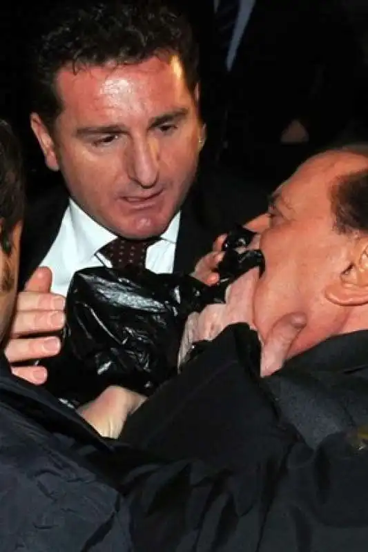 silvio berlusconi dopo l attacco di tartaglia