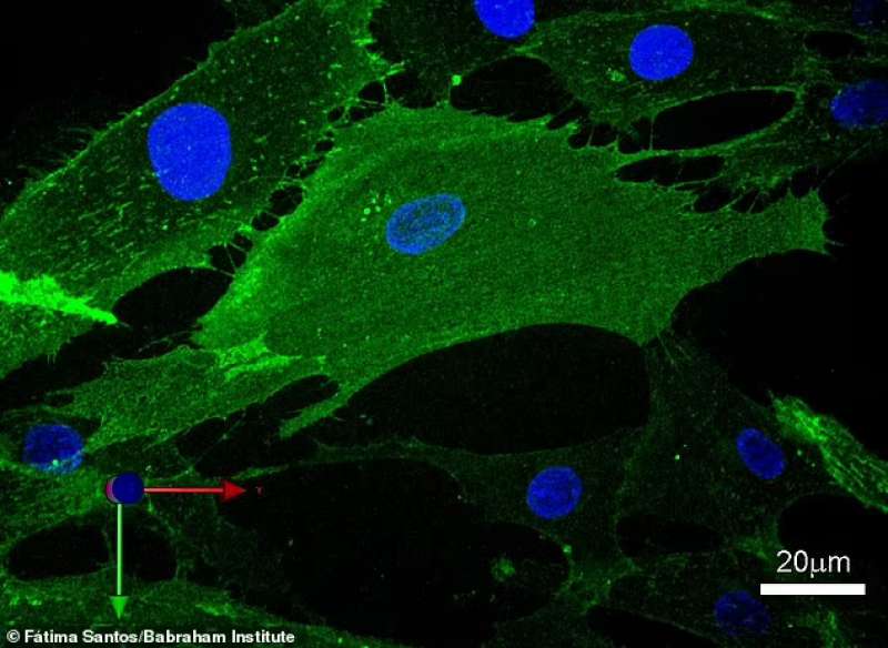 Fibroblasti 3