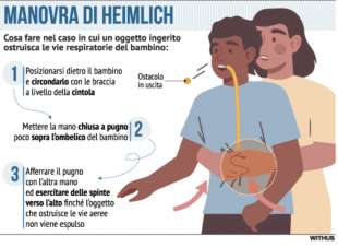 manovra di heimlich