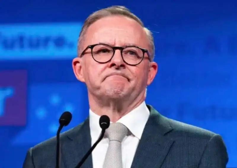 Anthony Albanese