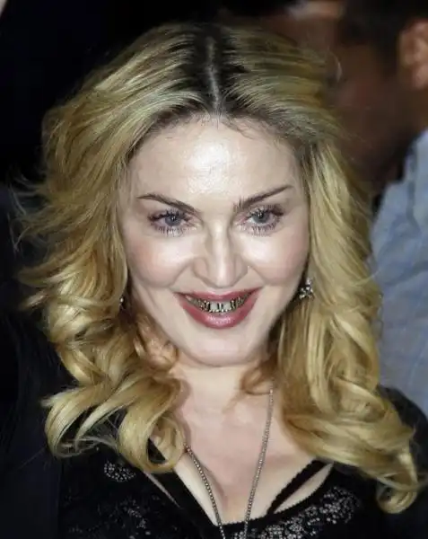 madonna denti oro 