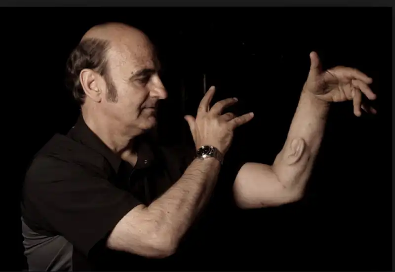 stelarc ha un orecchio sul braccio