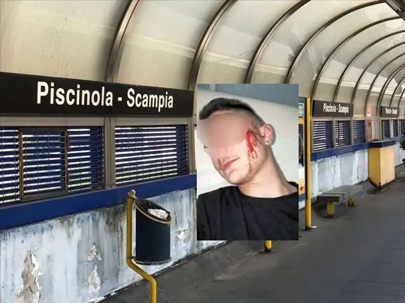 EMANUELE IL 16ENNE AGGREDITO A SCAMPIA