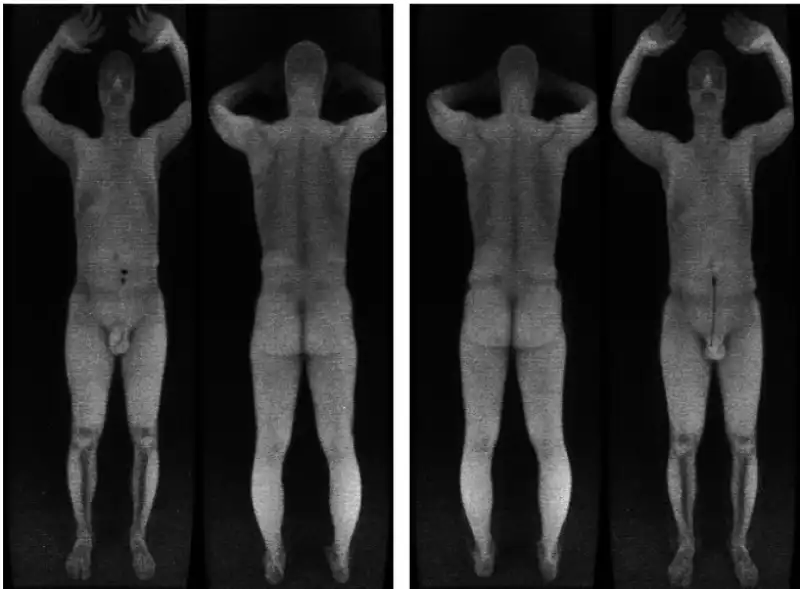 BODY SCANNER 