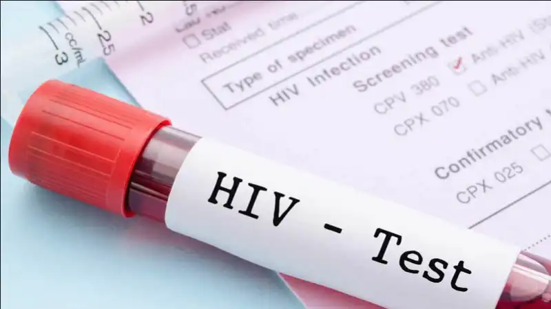 hiv test