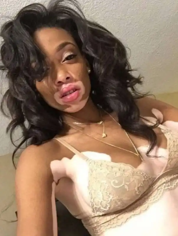 winnie harlow 6