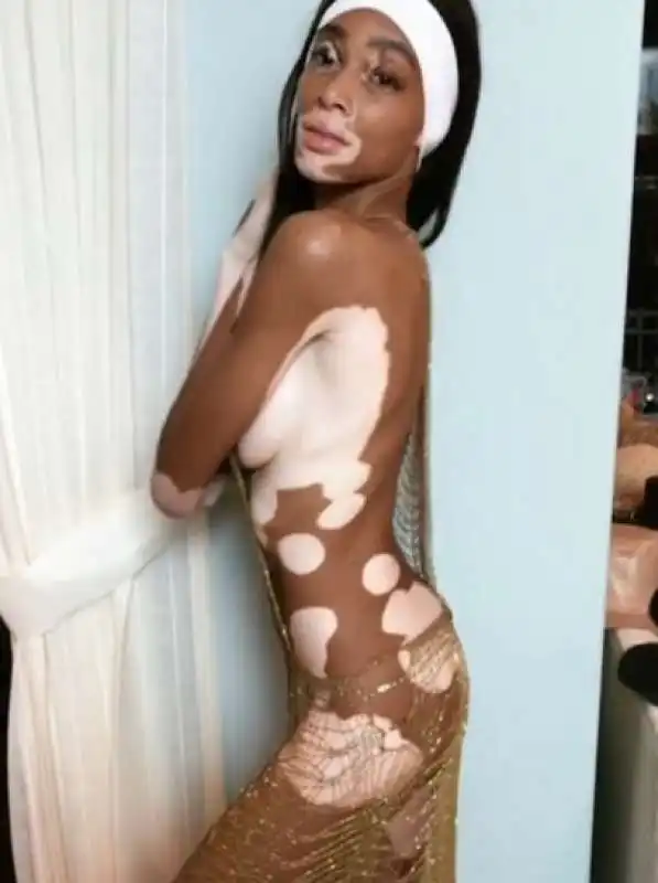 winnie harlow 9