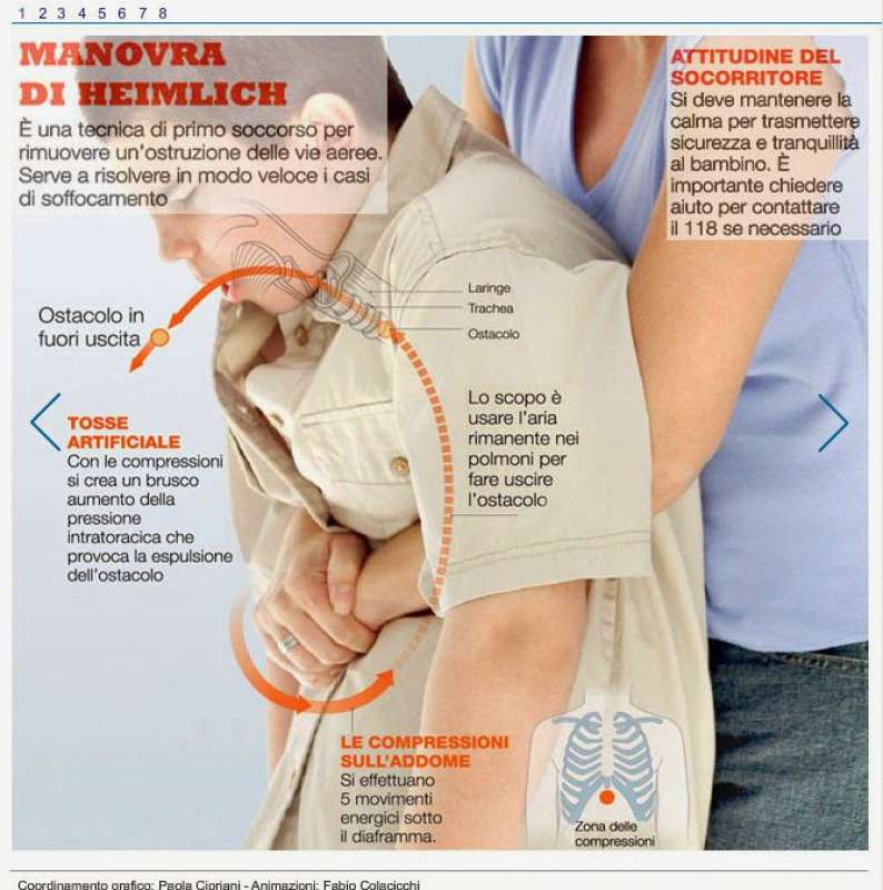 Manovra di Heimlich