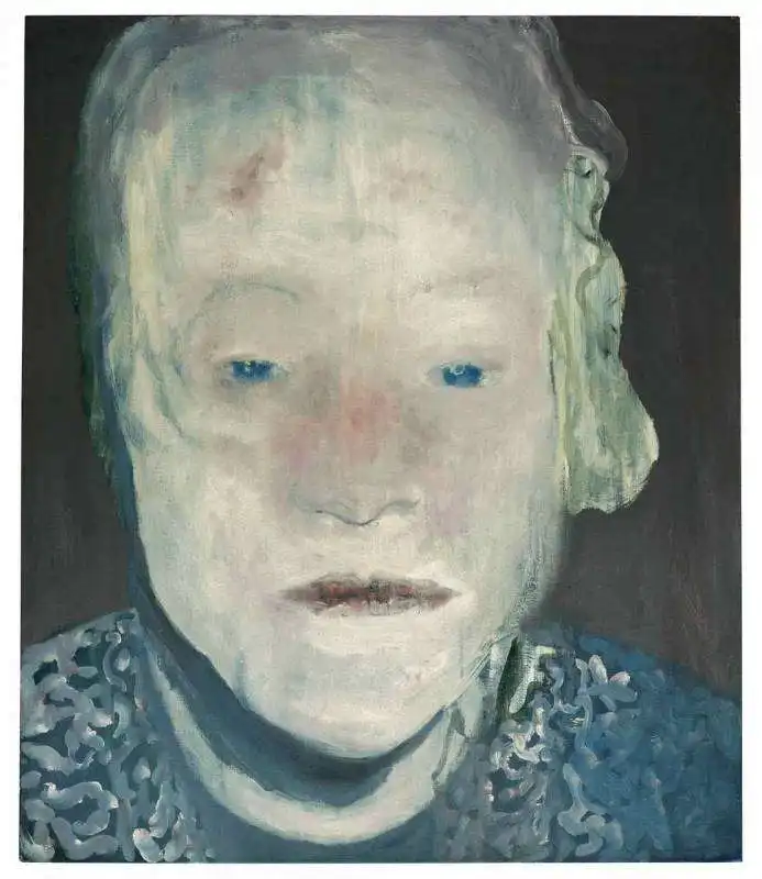 Marlene Dumas 'white disease'