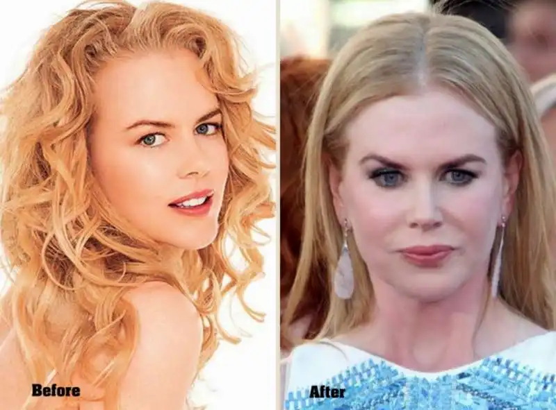 nicole kidman