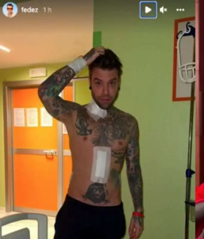 FEDEZ DOPO L'OPERAZIONE AL PANCREAS